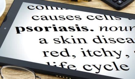 how to manage psoriasis