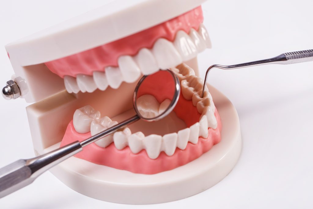 illustration of teeth aligners